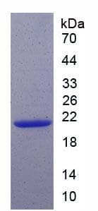 Mouse CDKN1A / WAF1 / p21 Protein (Recombinant His, N-Terminal)