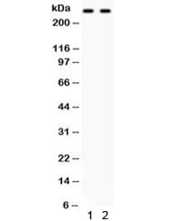 VCAN / Versican Antibody