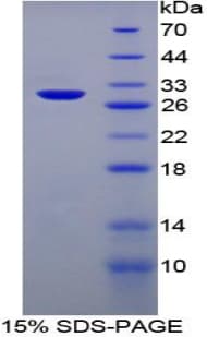 Rat SERPIND1 / Heparin Cofactor 2 Protein (Recombinant His-T7)