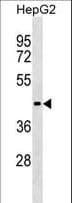ZBTB26 Antibody (aa110-136)