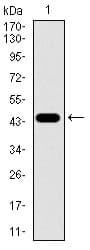 Monoclonal Mouse anti-Human Betaglycan / TGFBR3 Antibody (clone 1C5H11, aa147-328, WB)