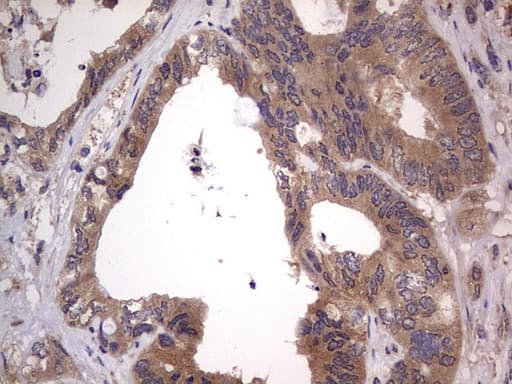 Monoclonal Mouse anti-Human SMPD1 / Acid Sphingomyelinase Antibody (clone OTI3H7, aa62-341, IHC, WB)