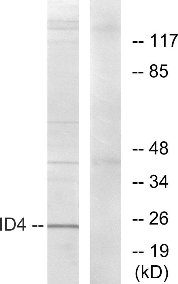 Polyclonal Rabbit anti-Human ID4 Antibody (WB)