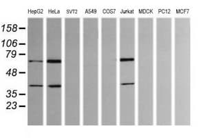 TRMT2A Antibody (clone OTI3B3)