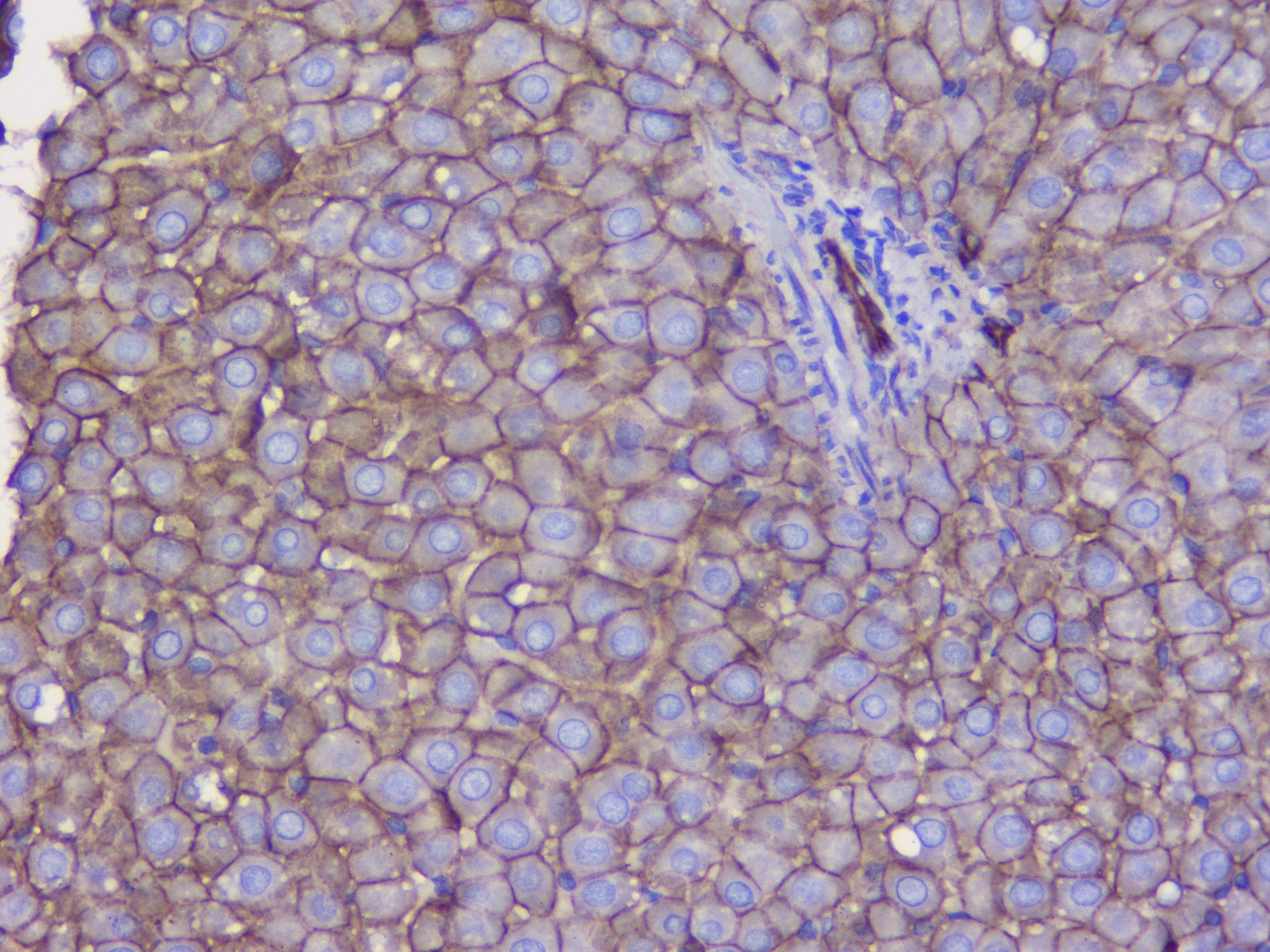 CTNNB1 / Beta Catenin Antibody