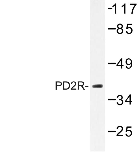 Prostaglandin D2 Receptor Antibody (Glu301)