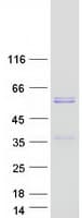 Human MYOC / Myocilin Protein (Recombinant Myc-DDK (Flag))