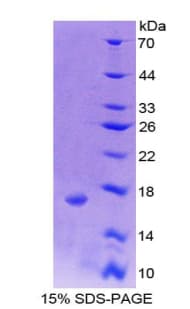 Human SNRPD1 / SMD1 Protein (Recombinant His-T7)