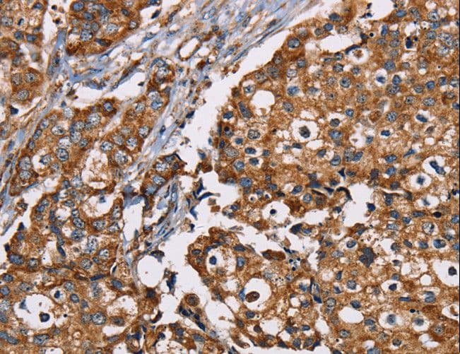 NDUFS1 Antibody