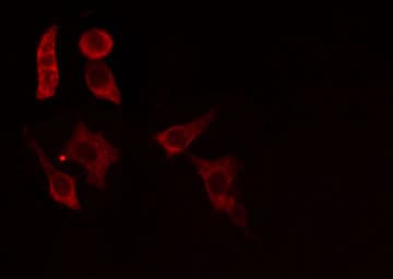 ACER1 / ASAH3 Antibody