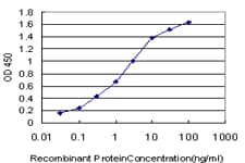 EIF2AK2 / PKR Antibody (clone 1D11)