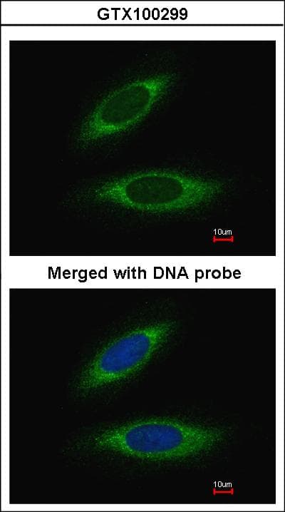 IHC-plus™ Polyclonal Rabbit anti-Human GSTP1 / GST Pi Antibody (N-Terminus, IHC, WB)