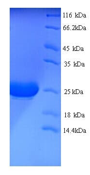 Rhesus monkey IL1A / IL-1 Alpha Protein (Recombinant His)