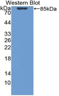 GC / Vitamin D-Binding Protein Antibody (aa17-476)