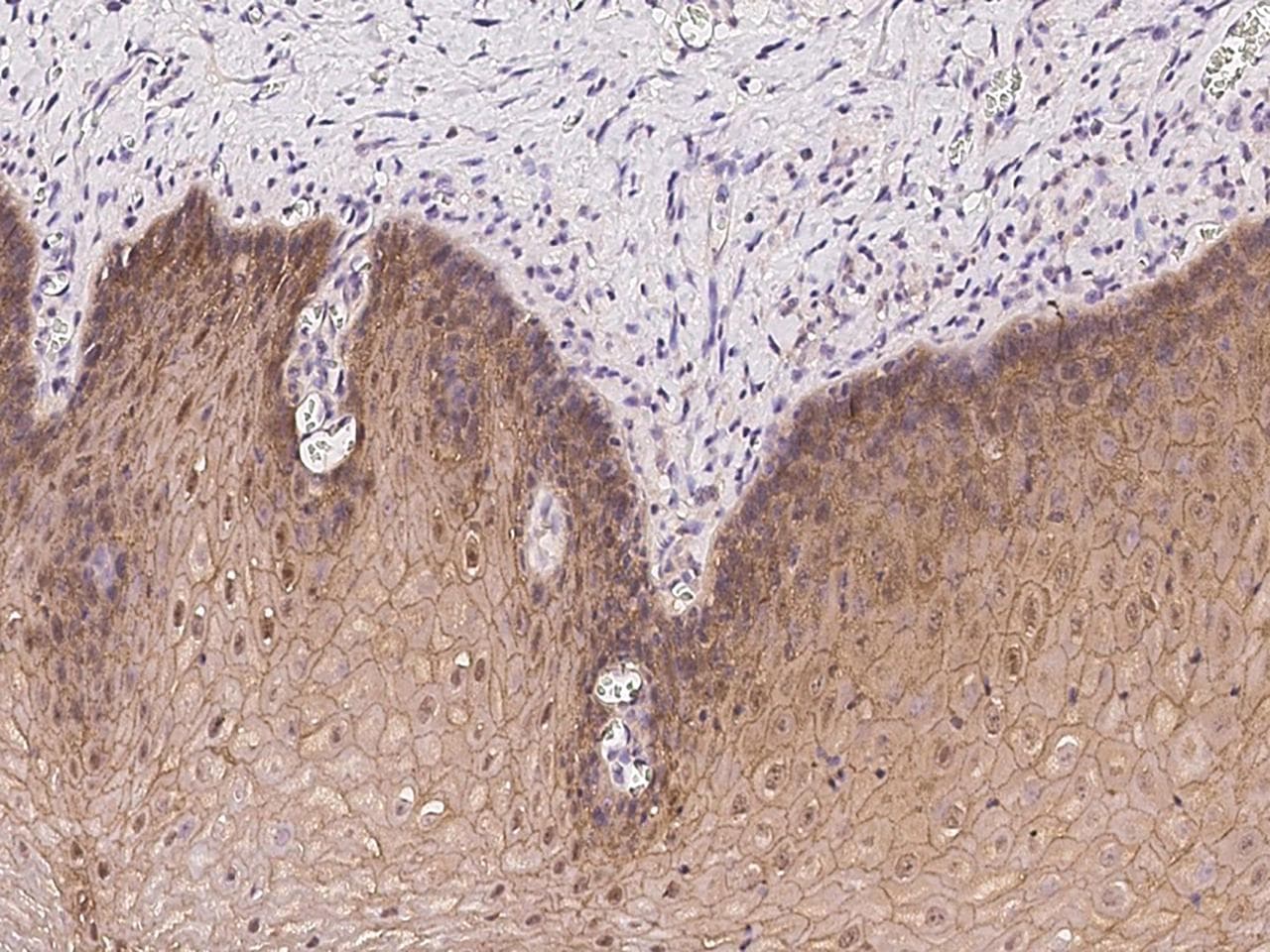 Polyclonal Rabbit anti-Human PKP1 / Plakophilin 1 Antibody (IHC)
