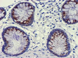 GOLM1 / GP73 / GOLPH2 Antibody (clone OTI2F3)