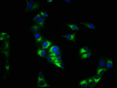 Polyclonal Rabbit anti-Human CXCR4 Antibody (IHC, WB)