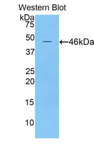 APOE / Apolipoprotein E Antibody (aa14-167)