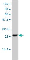 UROS Antibody (clone 1E11-B11)