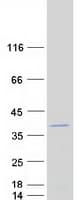 Human GEMIN8 Protein (Recombinant Myc-DDK (Flag))