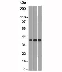 CCND1 / Cyclin D1 Antibody (clone SPM587, Azide-free, BSA-free)