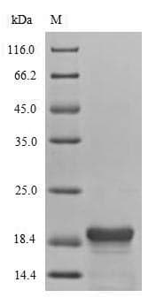 Serratia marcescens hns Protein (Recombinant 6His, N-terminus)