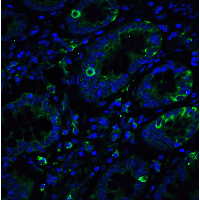 IHC-plus™ ERN1 / IRE1 Antibody