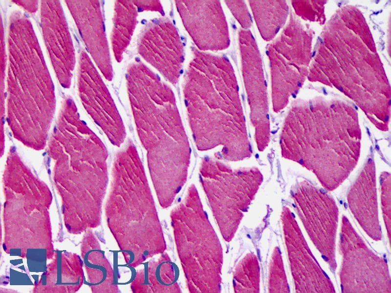 IHC-plus™ CAMK1D Antibody (clone 3H8)