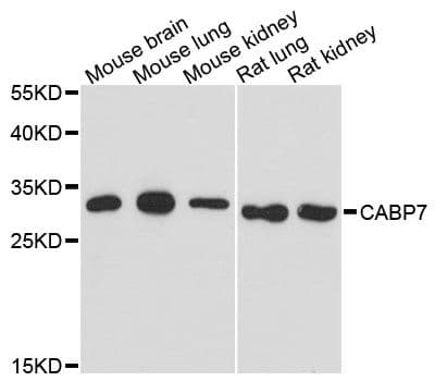 CABP7 Antibody