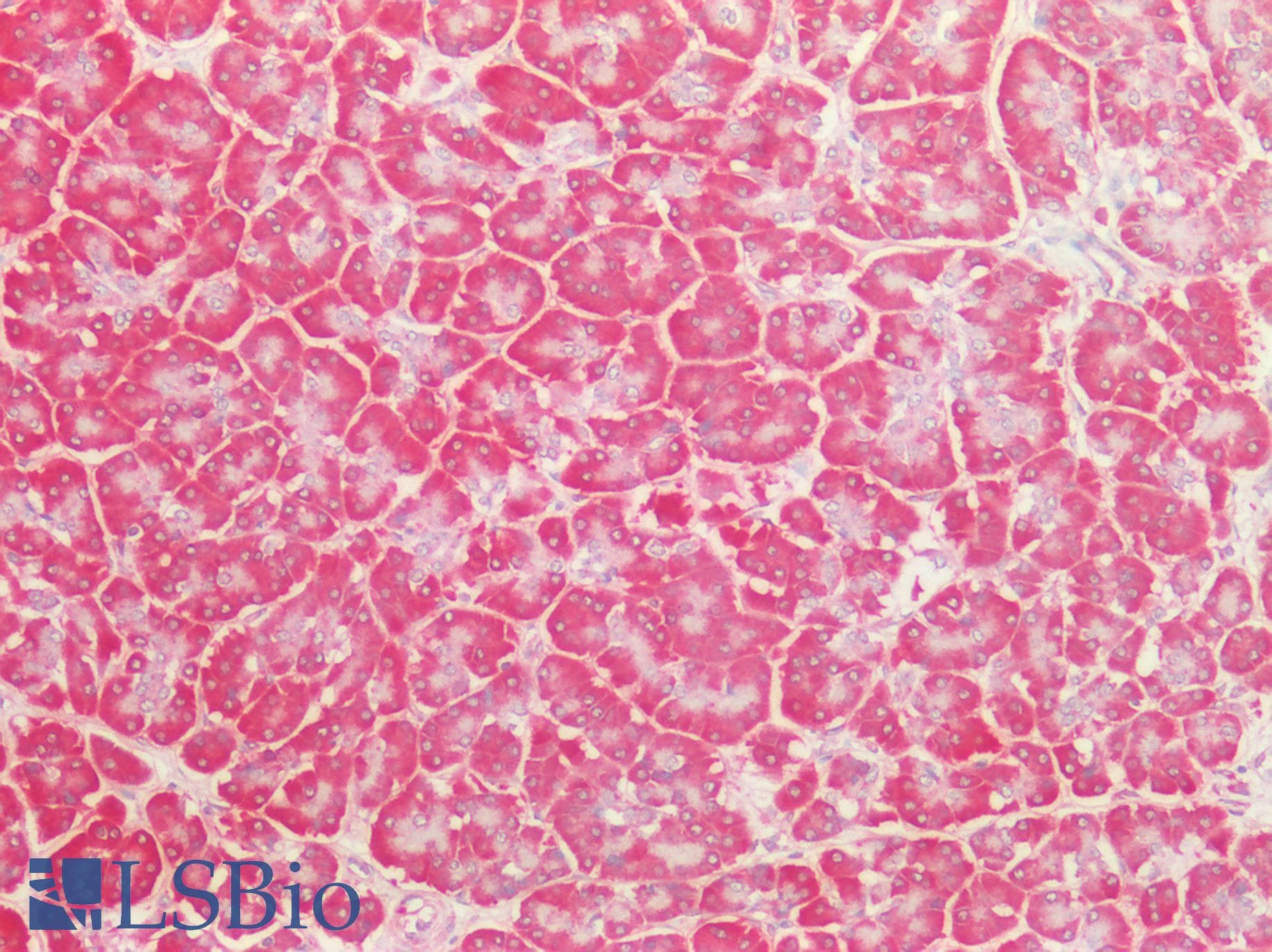 PathPlus™ Polyclonal Rabbit anti-Human BECN1 / Beclin-1 Antibody (N-Terminus, IHC, WB)
