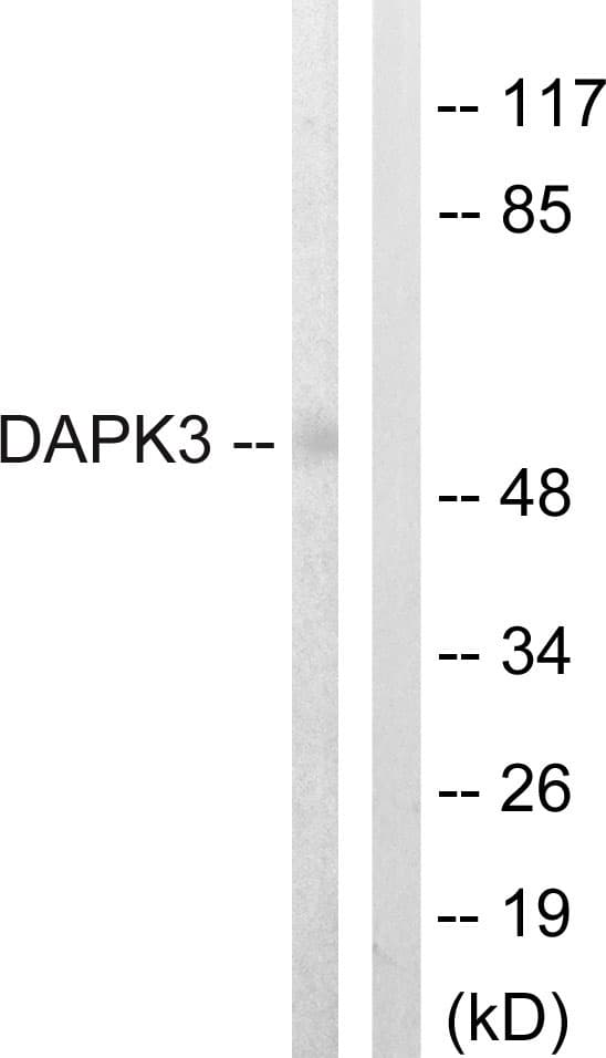 DAPK3 / ZIP Kinase Antibody (aa241-290)