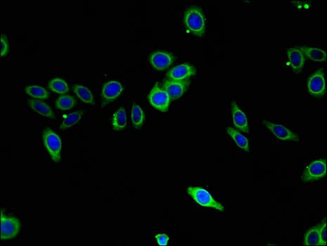 SPHK / SPHK1 Antibody
