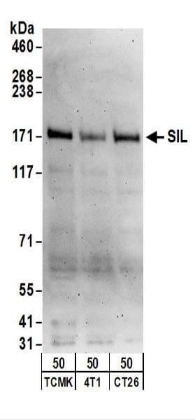 Polyclonal Rabbit anti-Human STIL Antibody (aa1237-1287, WB)