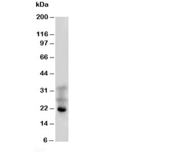 Polyclonal Rabbit anti-Human FGF4 Antibody (aa84-97, WB)