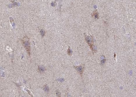 Polyclonal Rabbit anti-Human GRIN2B / NMDAR2B / NR2B Antibody (phospho-Tyr1336, IHC, IF, WB)