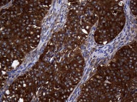 NME1 / NM23 Antibody (clone OTI24A2)