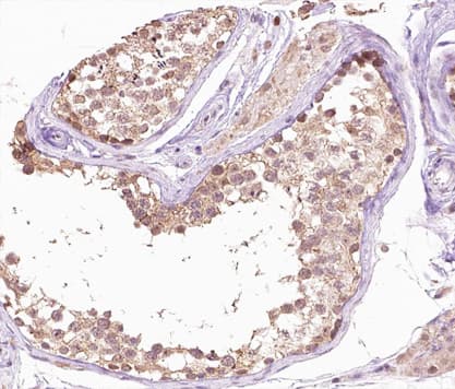 SENP6 Antibody