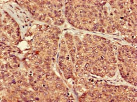 PTGER3 / EP3 Antibody