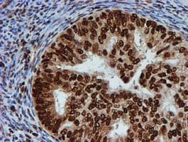 FMR1 / FMRP Antibody (clone OTI3B4)