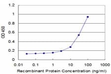 RPS3 / Ribosomal Protein S3 Antibody (clone 2A8)