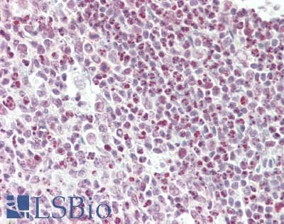 IHC-plus™ JHDM1A / KDM2A Antibody (aa825-875)