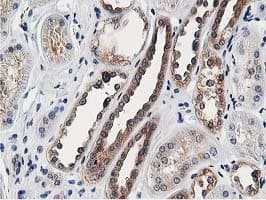 OSBP Antibody (clone OTI1F2)