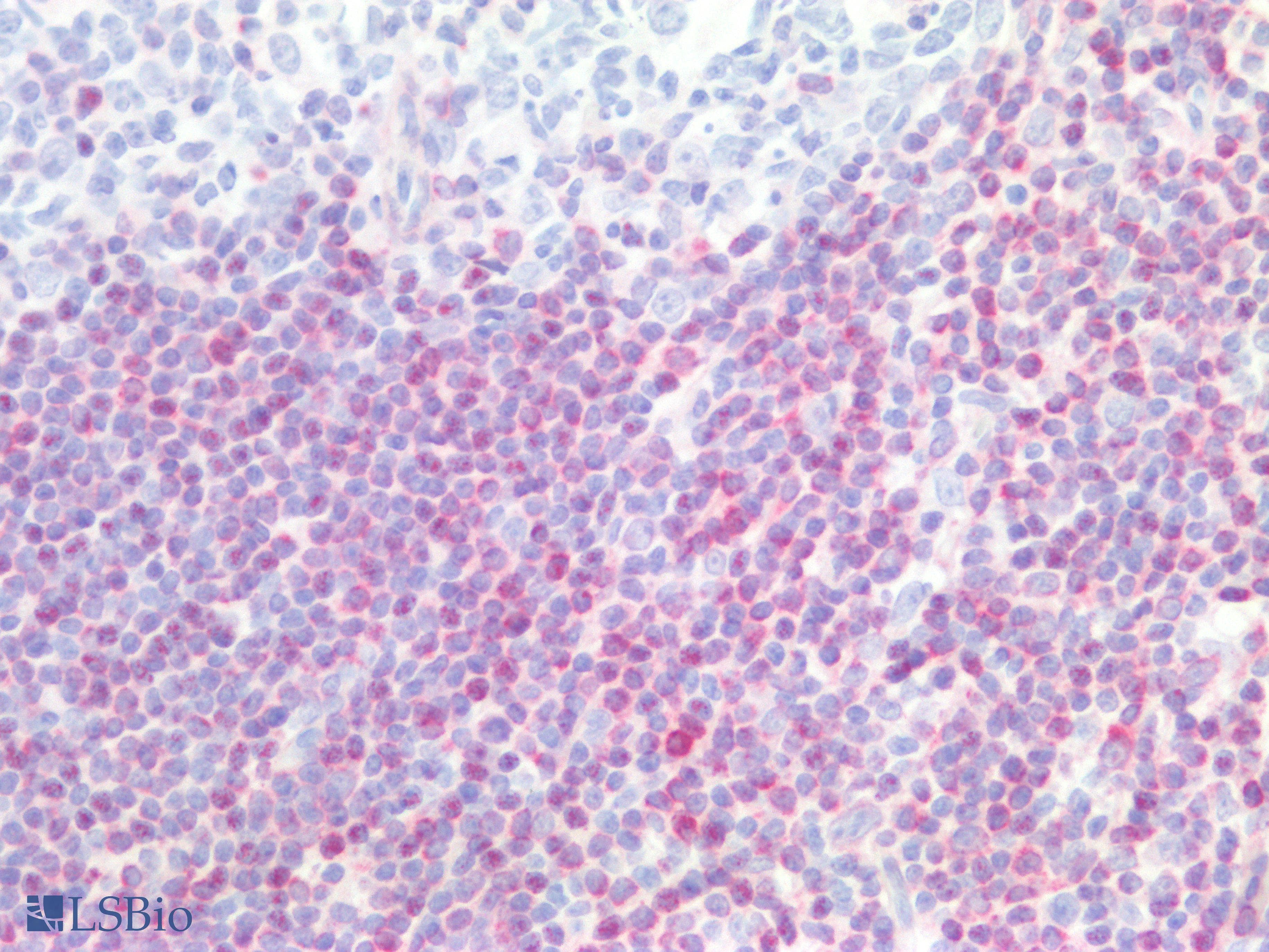 PathPlus™ Monoclonal Mouse anti-Human BCL2 / Bcl-2 Antibody (clone 124, aa41-54, IHC, IF, WB)