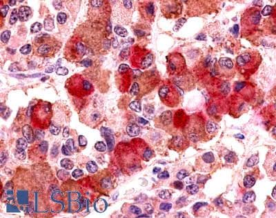 PathPlus™ Polyclonal Rabbit anti-Human AVPR1B Antibody (Cytoplasmic Domain, IHC)