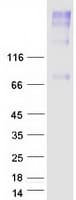 Human SLC44A4 Protein (Recombinant Myc-DDK (Flag))