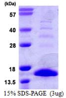 Mouse S100A9 / MRP14 Protein (Recombinant His)