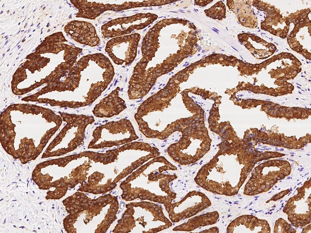 PHGDH Antibody
