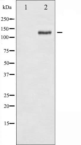 Polyclonal Rabbit anti-Human FAK / Focal Adhesion Kinase Antibody (phospho-Tyr925, IF, WB)