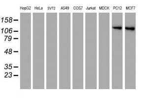 ENPEP / Aminopeptidase A Antibody (clone OTI4G8)