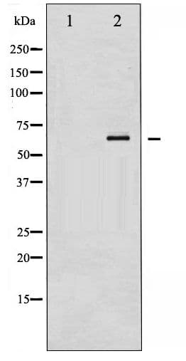 RELA / NFKB p65 Antibody (phospho-Ser536)